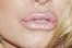 Jessica Simpson lips.