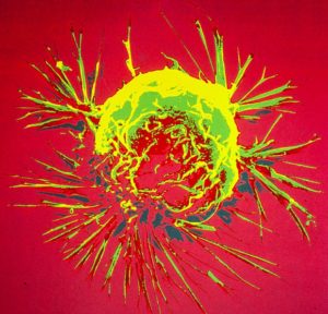 Image of a breast cancer cell courtesy the National Cancer Institute.